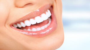 cholla family dentsitry scottsdale teeth whitening